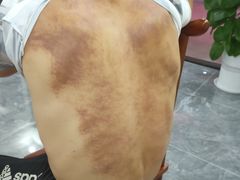 -张钰强中医正骨推拿连锁(唐家人才公寓店)