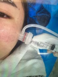 -杭州米兰柏羽医疗美容医院