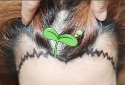 -大麦微针植发全国连锁