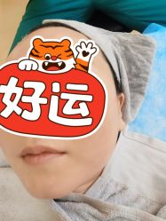 体验后-北京爱育华医院-医疗美容科