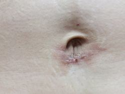 -成都军建医院·疤痕诊疗中心