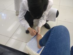 -派恩宜灰指甲鸡眼嵌甲手足癣