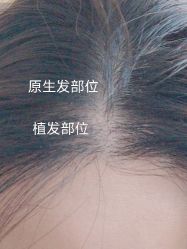 -新生植发·植养护一体