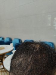 -碧莲盛·不剃发植发