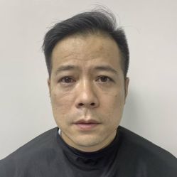 点击看大图 -广州健丽·去眼袋医疗美容机构