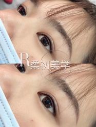 -RC半永久纹眉纹发际线