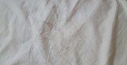 -大麦微针植发全国连锁