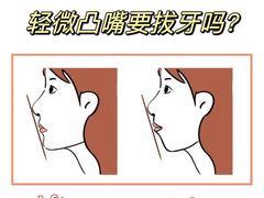 -极光口腔·矫正种植修复(锦江店)