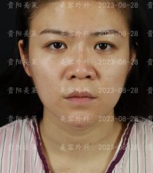 -贵阳美莱医疗美容整形医院