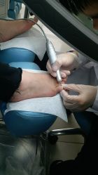 -派恩宜灰指甲鸡眼嵌甲手足癣