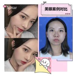 -Yestar艺星医疗美容医院