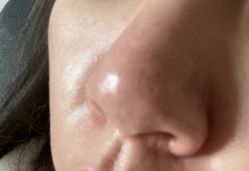-新美荟医美·专注面部美学抗衰