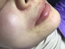 -悦己医疗美容整形线雕提升专门店