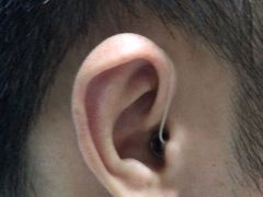 -宁耳听力助听器奥迪康峰力西门子斯达克(静安闸北店)