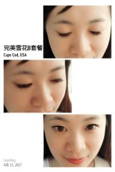 睫毛嫁接-光SPA科技美肤