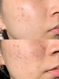 -SKINIST丽铂医疗美容