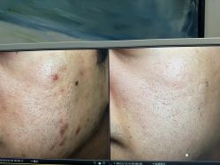 -苑苑vbeauty科技美容SPA