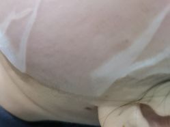 -美瑞莎创美医疗美容