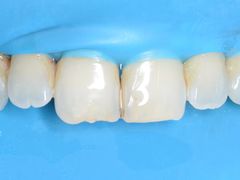 -新达口腔(华东理工大学店)