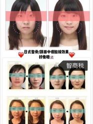 -成都大华医学美容医院