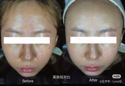 点击看大图 -栖SPA·ONDA ·美芙炫·海菲秀科技美肤中心