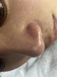 -痘院长·祛痘·科技美肤