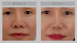 -SKINIST丽铂医疗美容