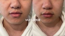 -MUFI·美悦菲塑颜美容SPA