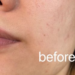 体验前-东莞缔美美容医院