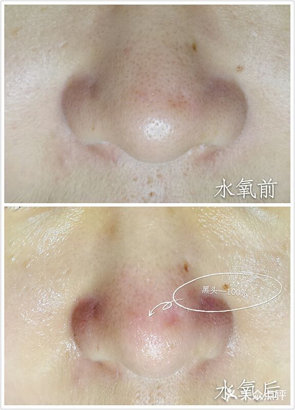 光SPA科技美肤(哈德门购物中心店)水氧图片