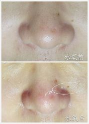 水氧-光SPA科技美肤