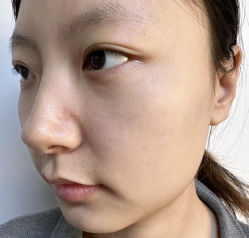 -LUNA皮相美·骨相美高级美感
