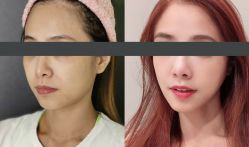 -SKINIST丽铂医疗美容