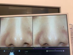 -苑苑vbeauty科技美容SPA