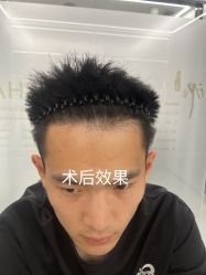 -熙朵美学植发·连锁品牌