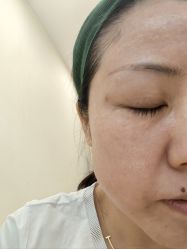 -海涛医疗美容·面部抗衰·注射美鼻