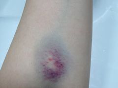 -上海市青浦区朱家角人民医院