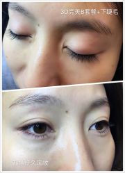 睫毛嫁接-光SPA科技美肤