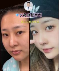 -北京米扬丽格医疗美容·联合丽格鼻整形中心