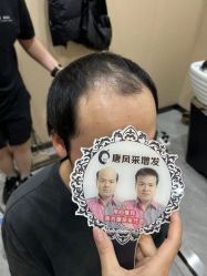 -唐风采假发补发定制