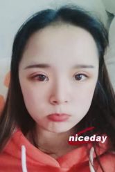 -成都西区医院整形美容