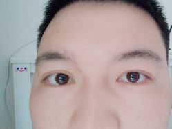 体验后-西安伊美尔医疗美容医院