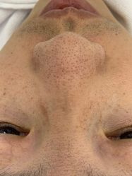 -痘敏医生专业祛痘连锁