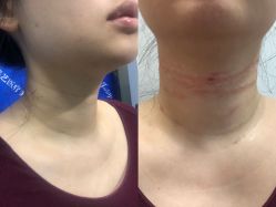 体验前-郡艺医疗美容·微整·眼鼻吸脂