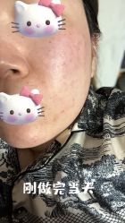 体验前-安徽合肥韩美整形外科医院