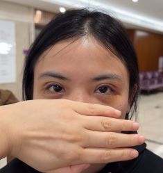 体验后-厦门美莱整形美容医院