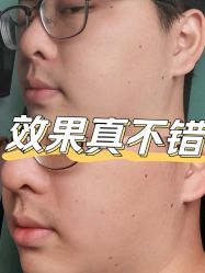-成都艾特他整形外科医院