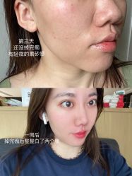 -慕颜医疗美容·皮肤微整 抗衰