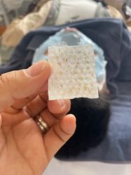 -瑶芳清颜草本祛痘