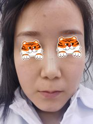 点击看大图 体验前-成都艾特他整形外科医院